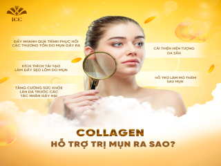 Da mụn có nên sử dụng XS MAX Collagen không?
